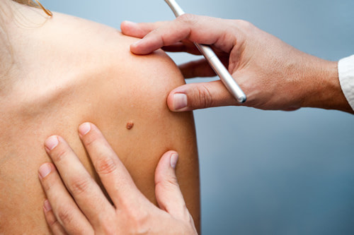 doctor Surgical Removals London